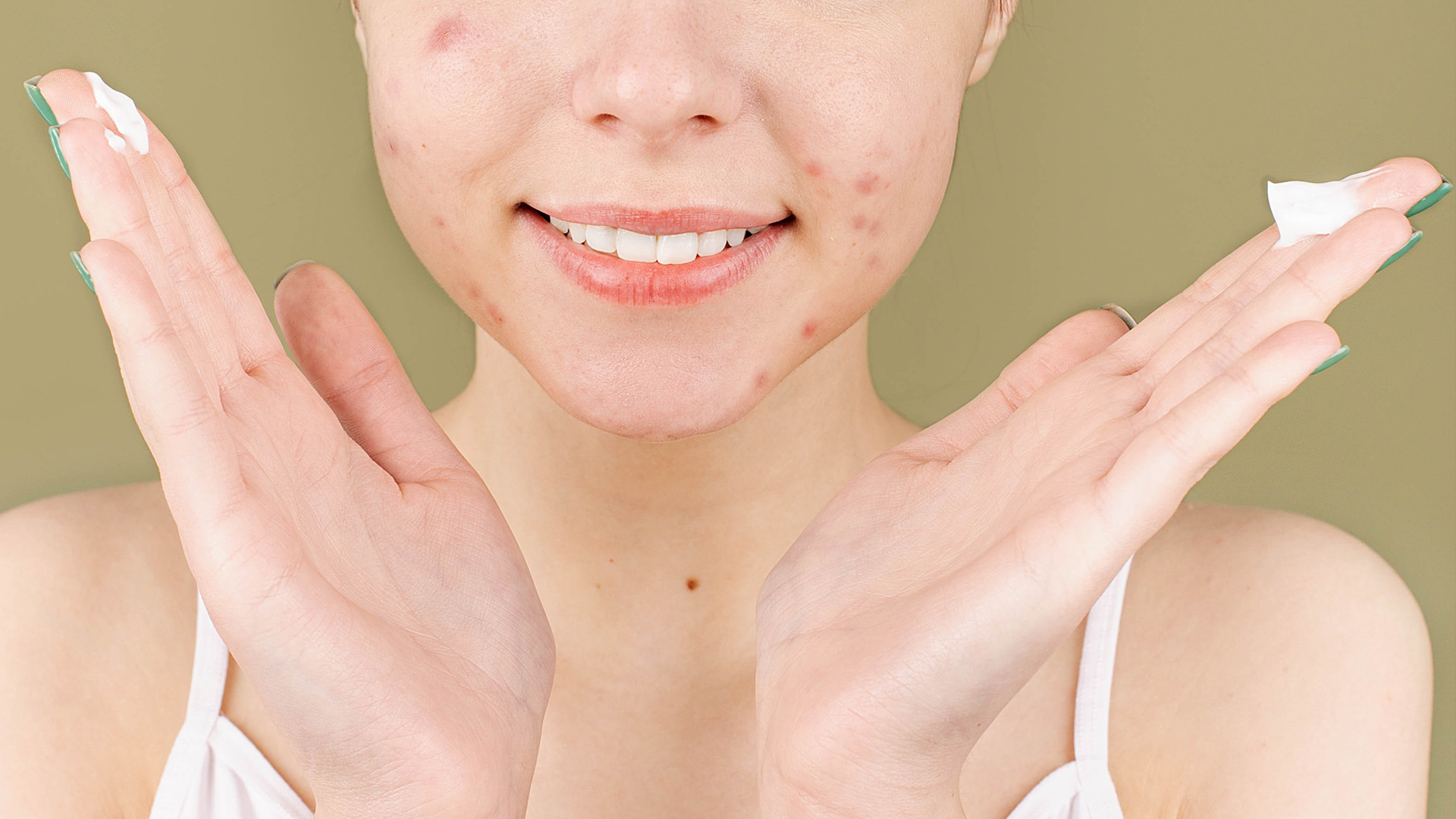 7 Little Known Acne Skin Care Secrets