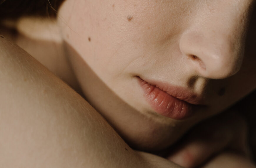 3 Top Acne Skin Care Tips For A Healthier Skin