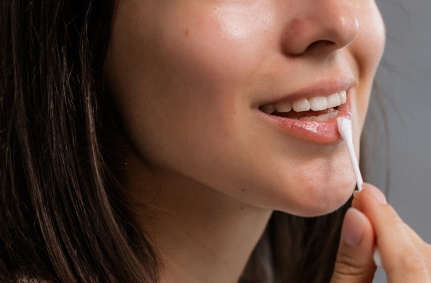 Tips For Chapped Lips